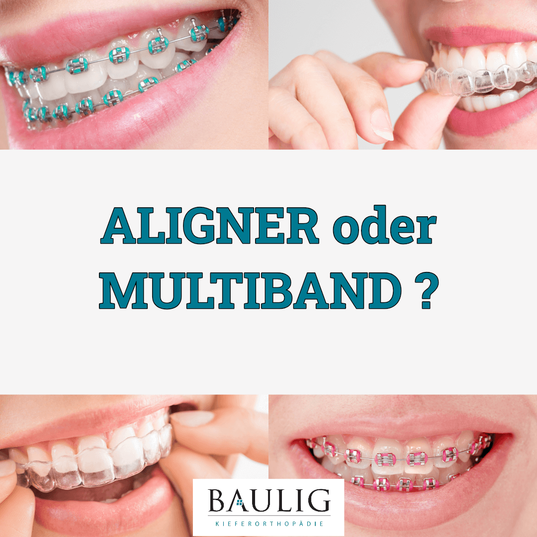 Aligner oder Multiband?