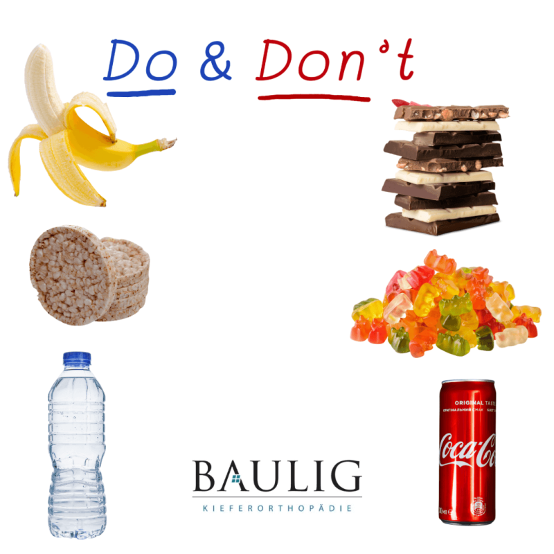 Zahnspange im Alltag – Dos and Donts Zahnspange im Alltag - was ist erlaubt und was nicht?