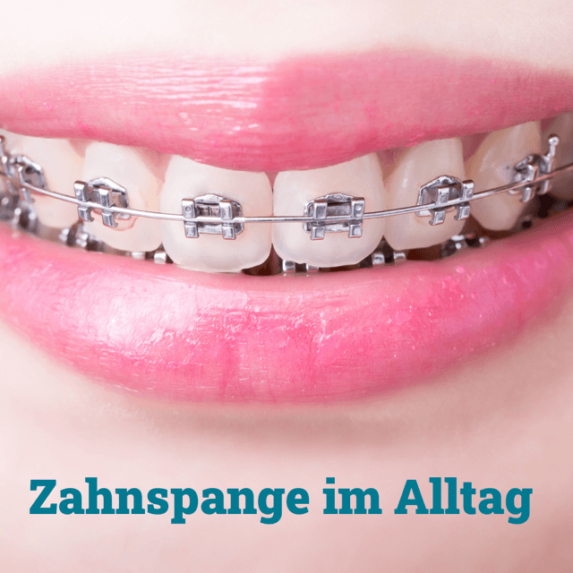 Alltag und feste Zahnspange